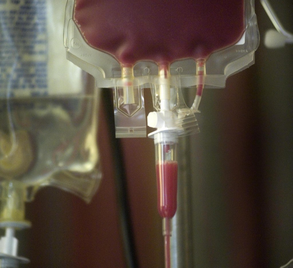 Bone Marrow Transplant Consult&nbsp;#2